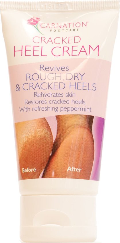 Carnation Cracked Heel Cream 50ml